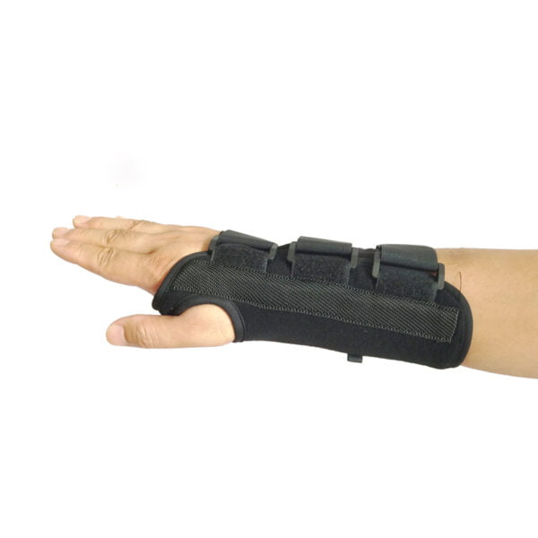 Carpal Tunnel Syndrome